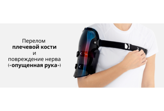 Иммобилизация кости сломанной без смещения