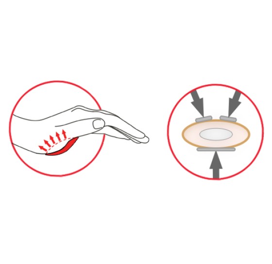 3-точечная фиксация L3P 