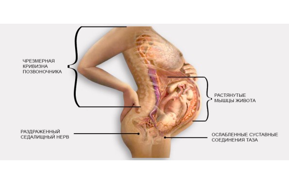 ОСАНКА ПРИ БЕРЕМЕННОСТИ