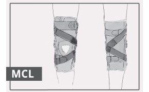 MCL