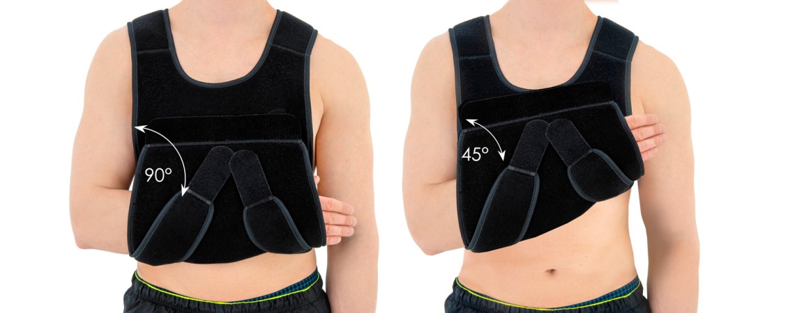 Позиционирование верхней конечности