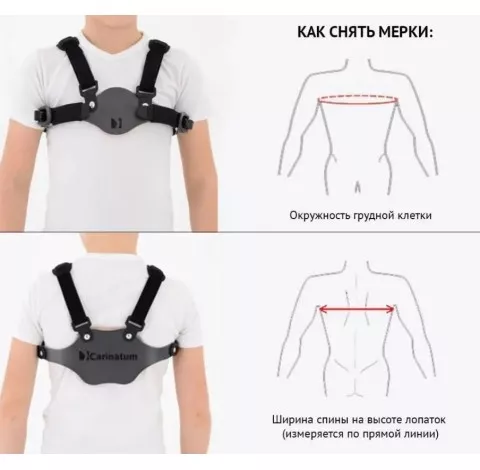 Ортез на клиновидную грудь Reh4Mat Carinatum Am-tx-04/24h