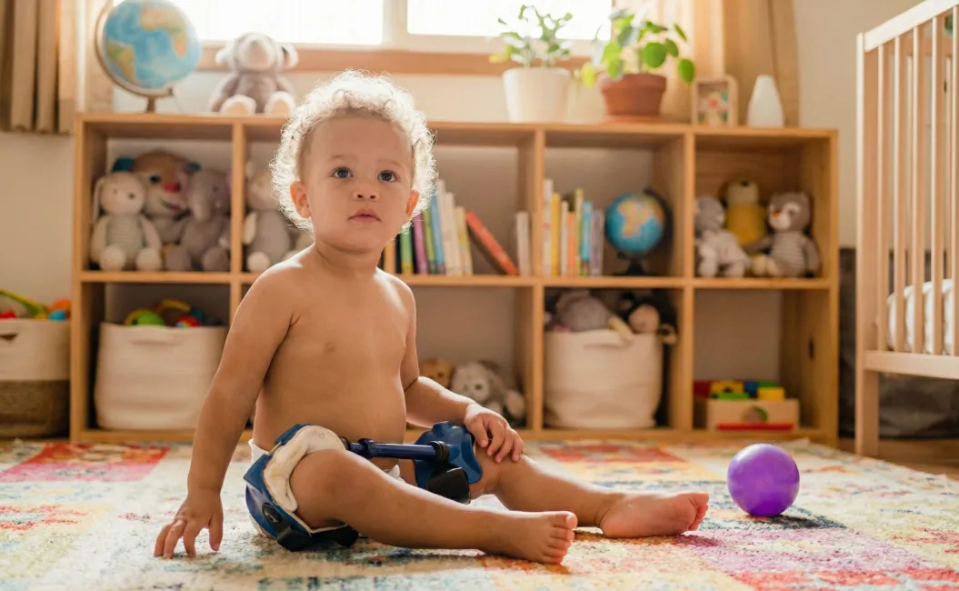 Дисплазия тазобедренного сустава у ребёнка