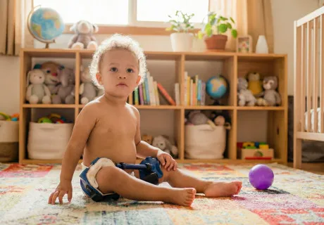 Дисплазия тазобедренного сустава у ребёнка: признаки, причины и современные методы терапии