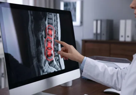 Спондилит: когда боль в спине говорит о серьезном заболевании